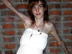 Anorexic extreamley skinny girls